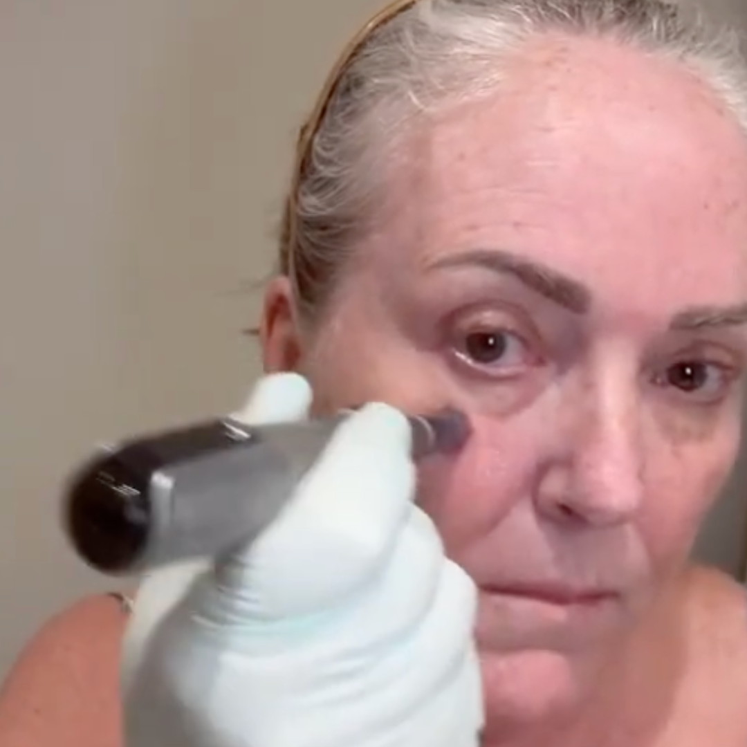 Dr. Pen M8S Microneedling Pen