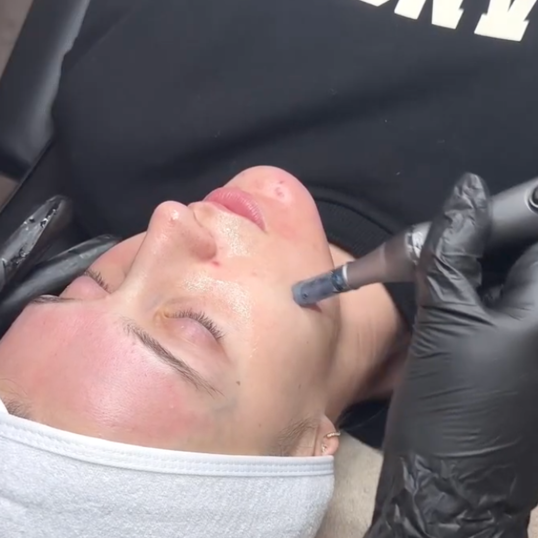 Dr. Pen M8S Microneedling Pen